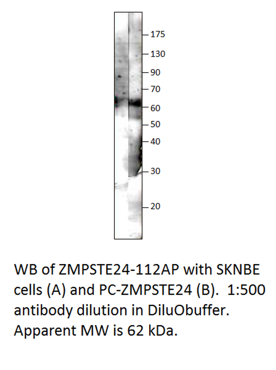 ZMPSTE24 Antibody from Fabgennix