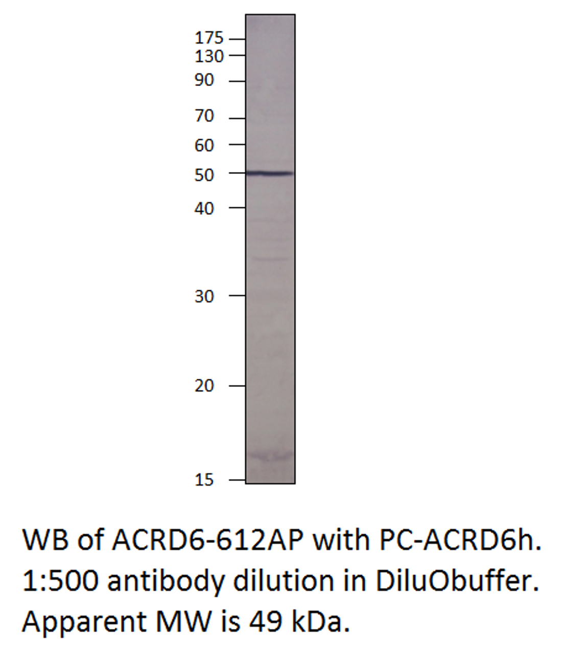 Atypical Chemokine Receptor D6 Antibody from Fabgennix
