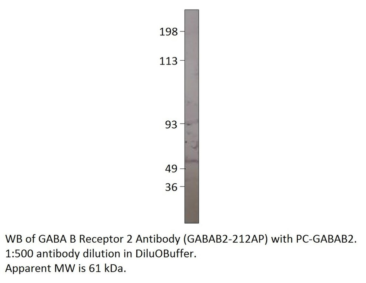 GABA B Receptor 2 Positive Control from Fabgennix