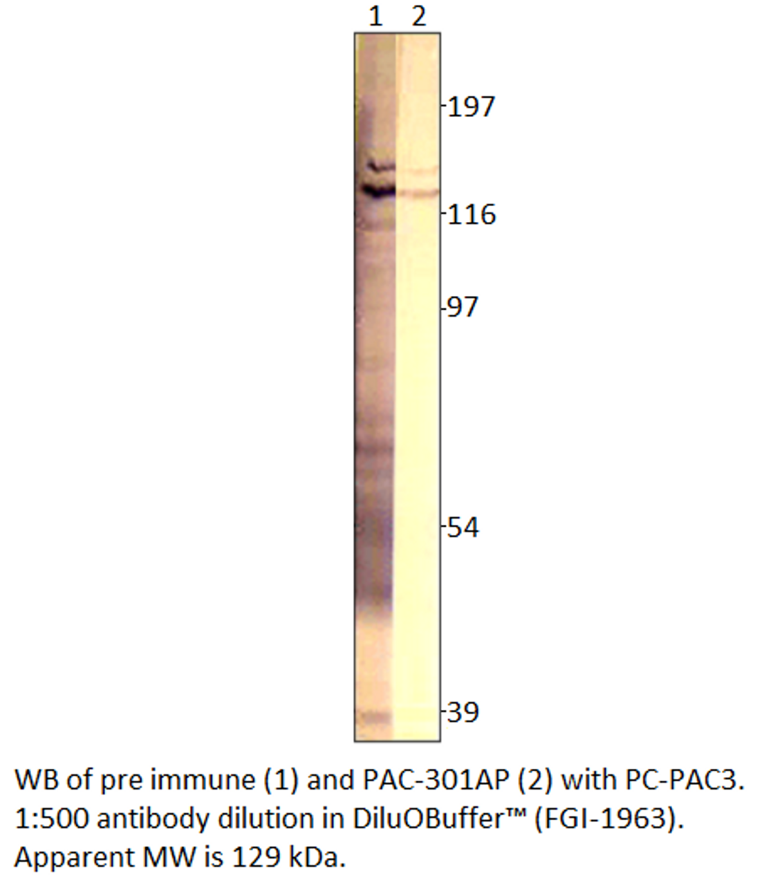 ADCY3 Positive Control from Fabgennix