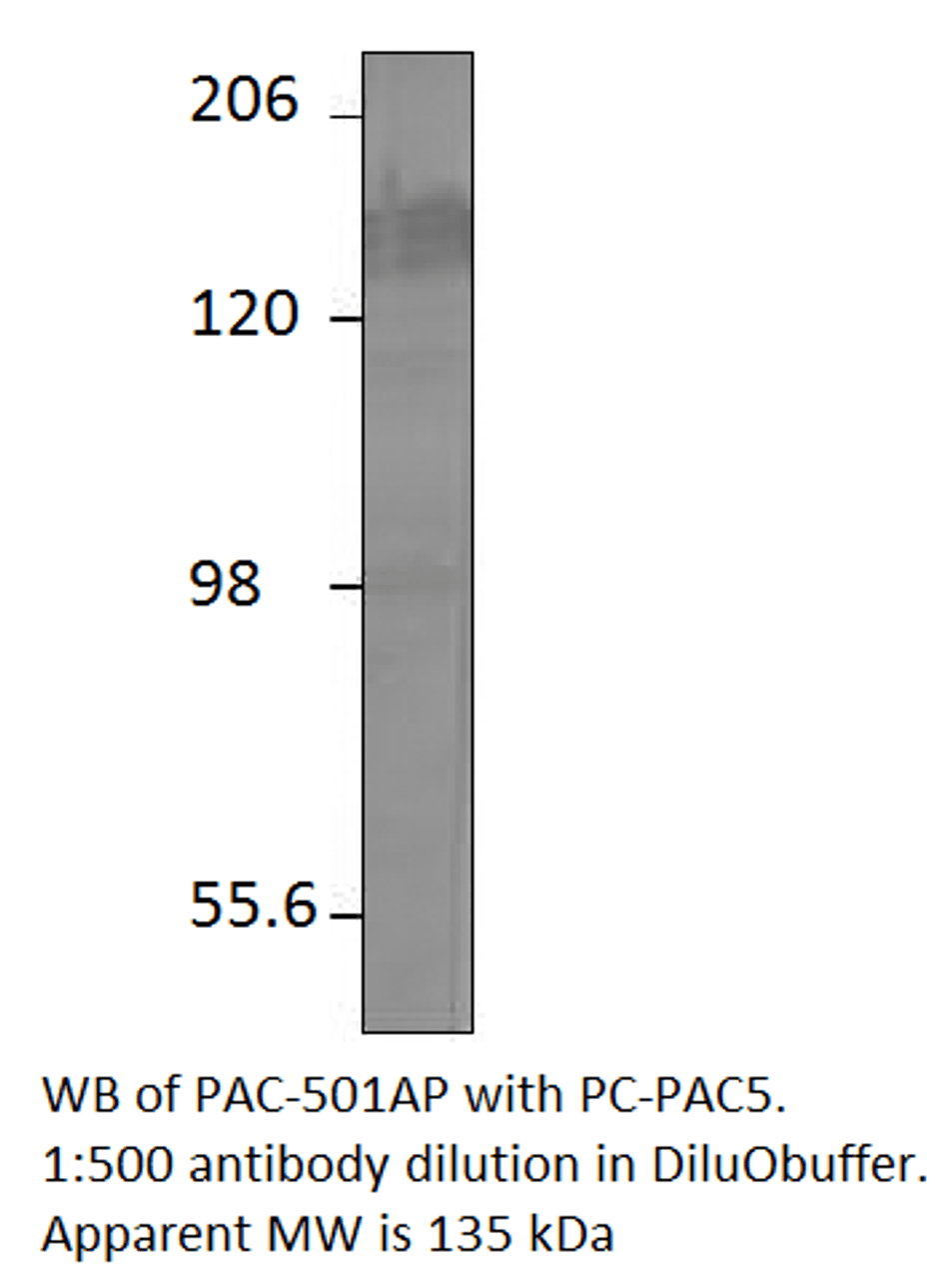 ADCY5 Positive Control from Fabgennix