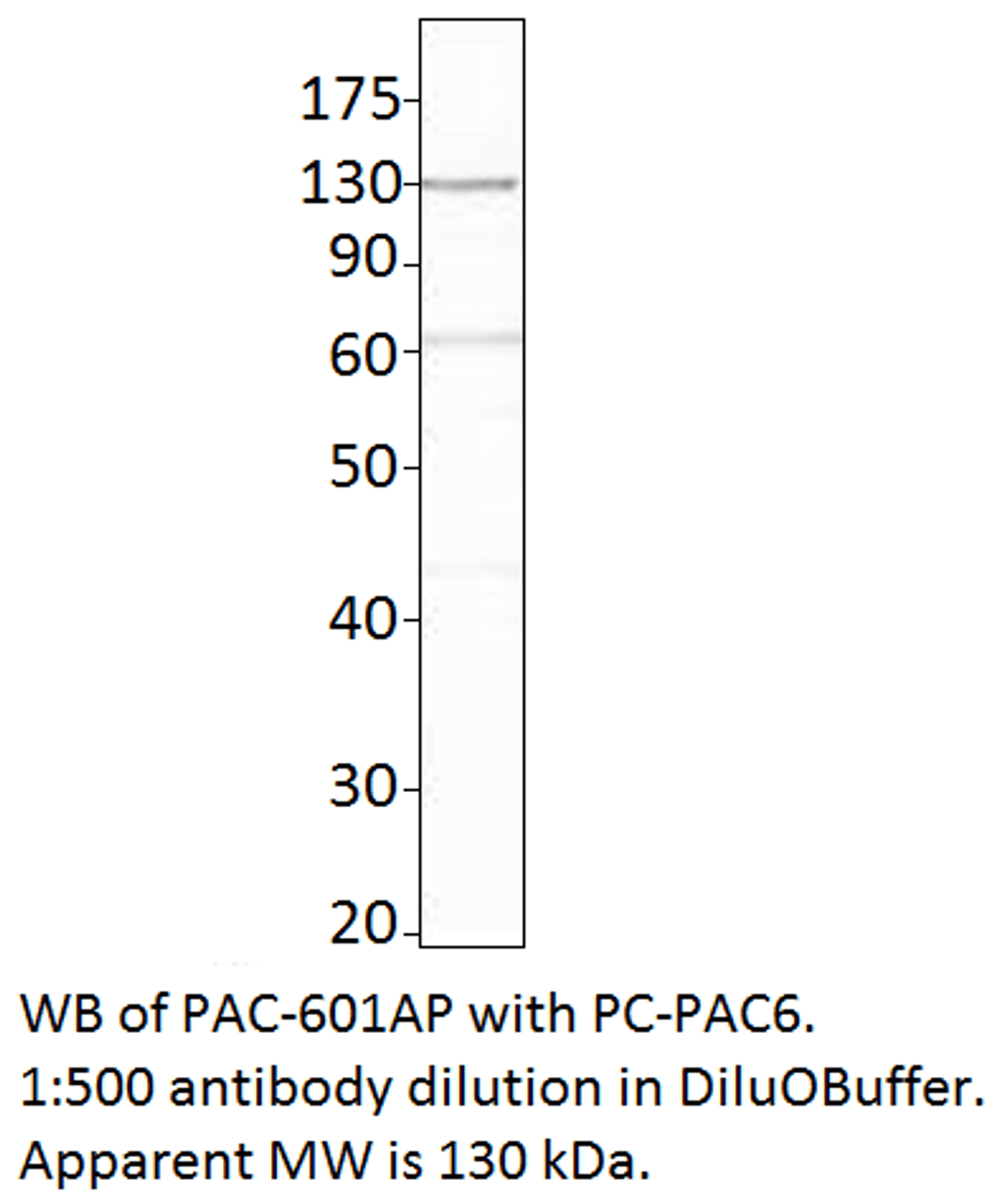 ADCY6 Positive Control from Fabgennix