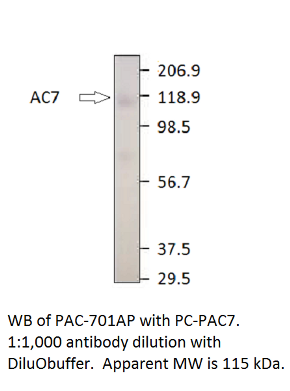 ADCY7 Positive Control from Fabgennix