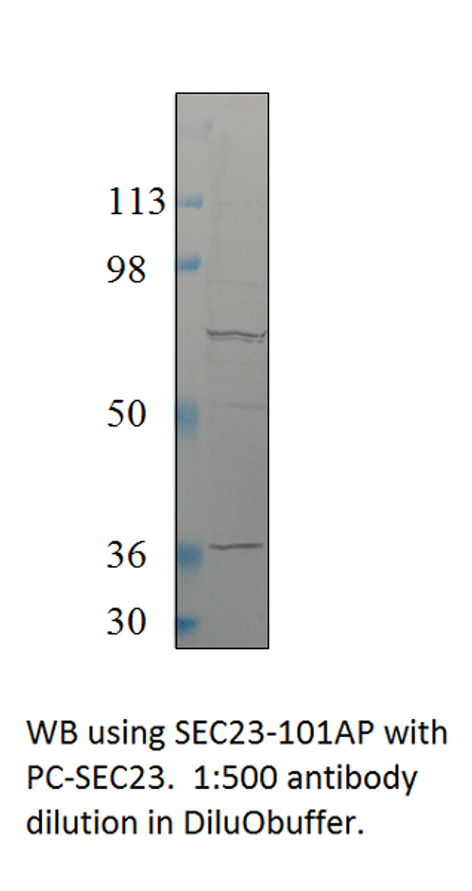 SEC23 Positive Control from Fabgennix