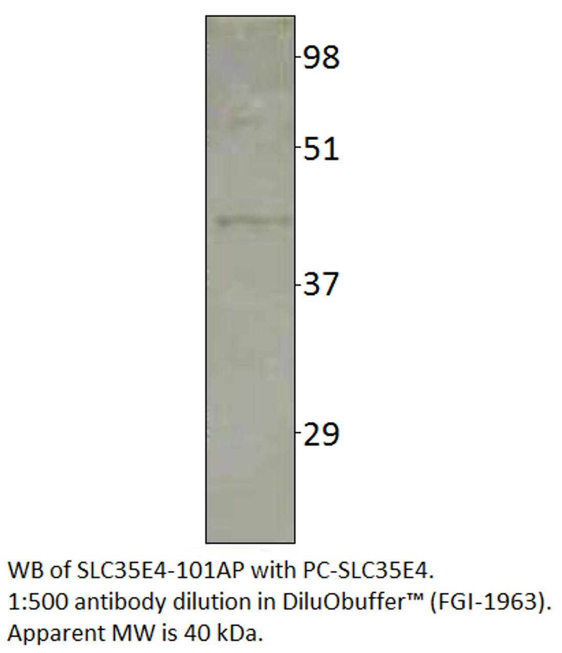 Solute carrier family 35 member E4 Antibody Positve Control from Fabgennix