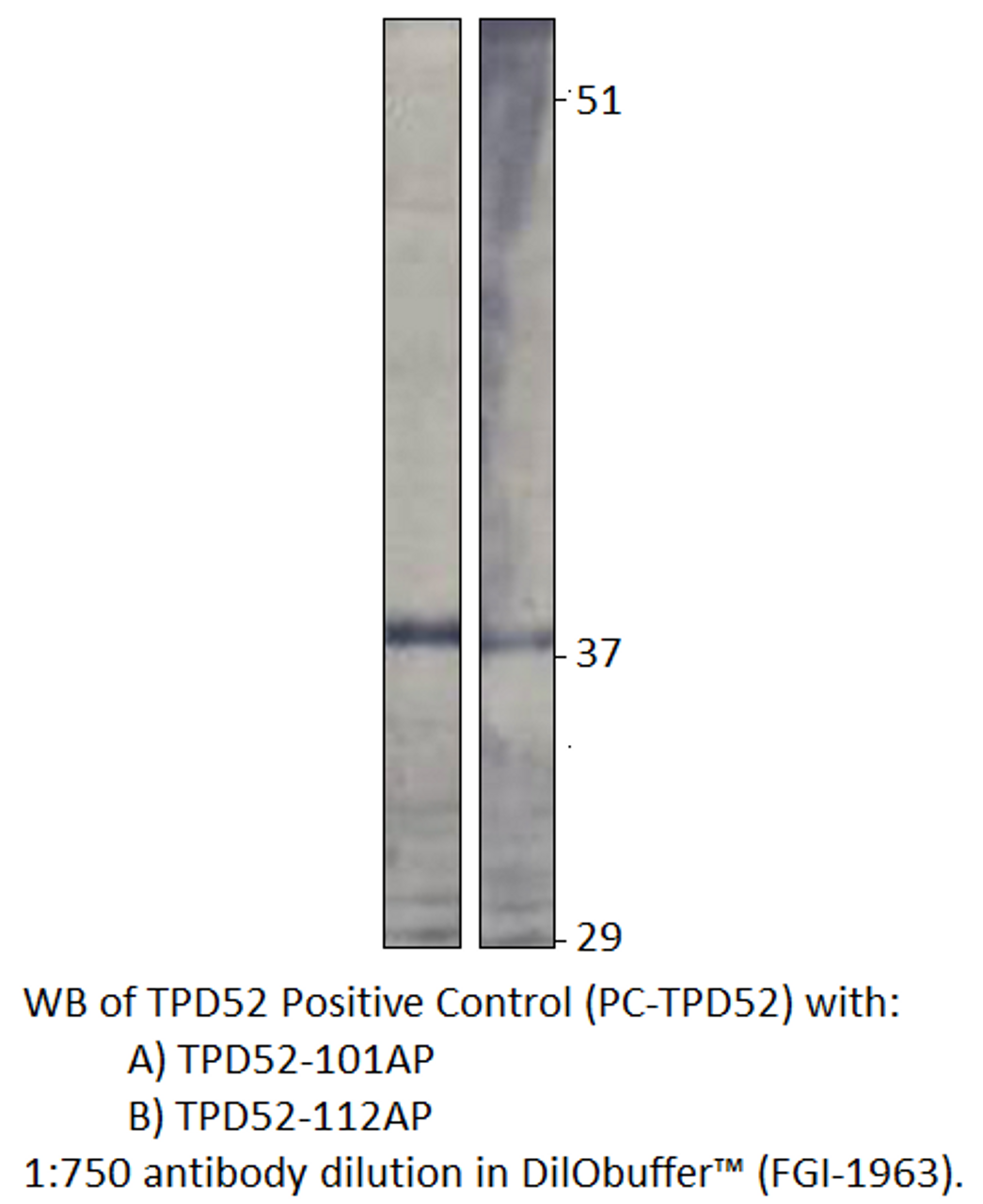 Prlz / TPD52 Positive Control from Fabgennix