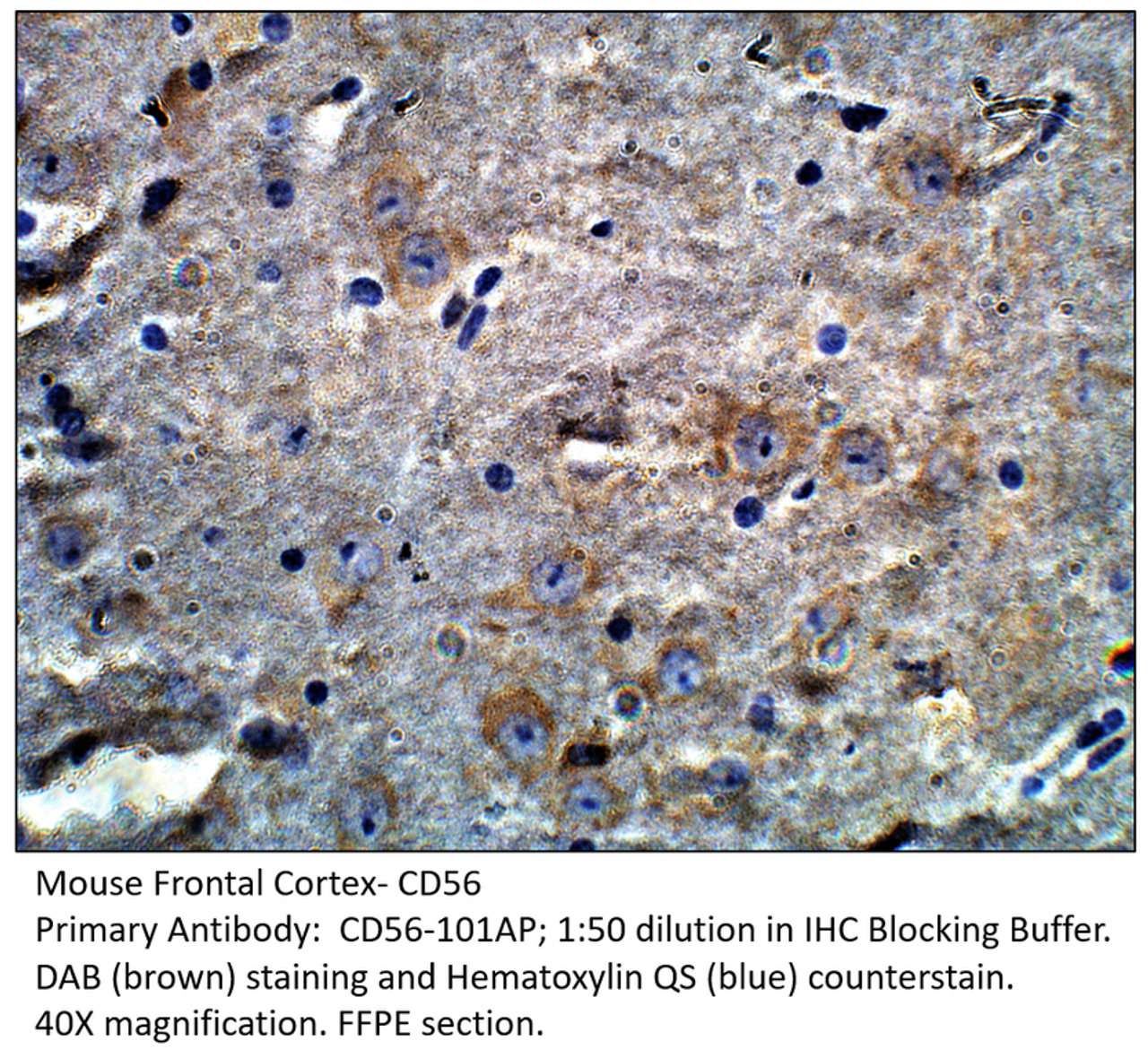 CD56 / NCAM Antibody from Fabgennix