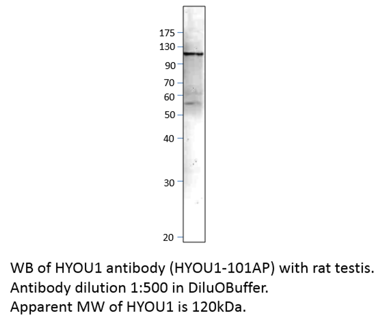 ORP150 Antibody from Fabgennix