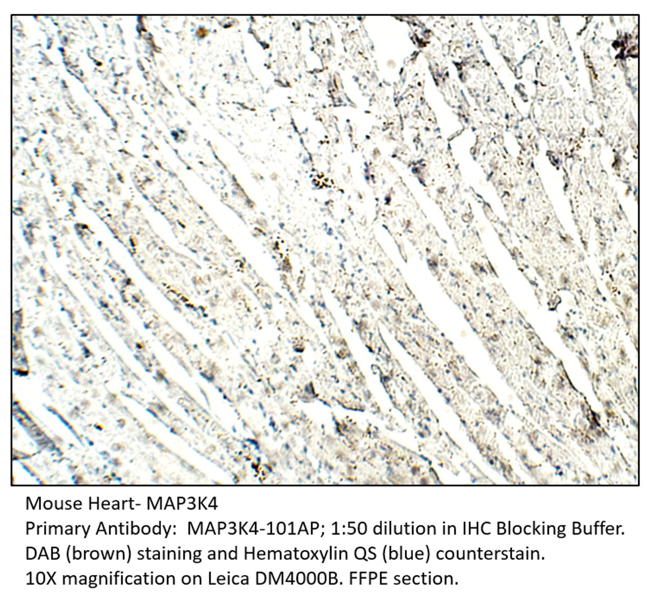 MAP3K4 Antibody from Fabgennix