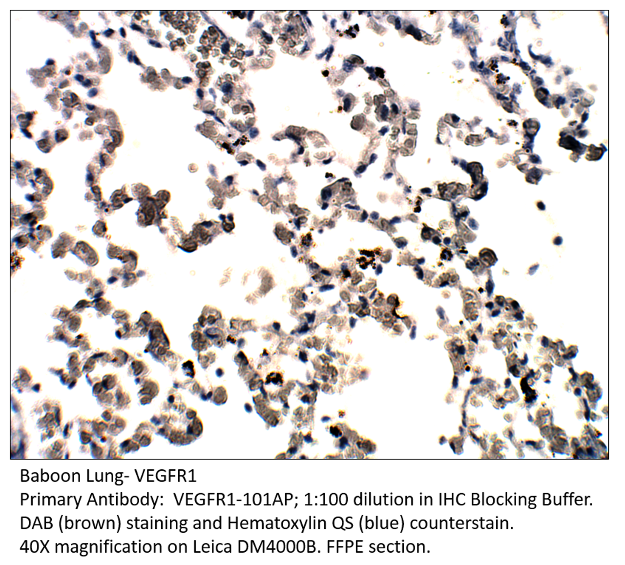 VEGFR1 Antibody from Fabgennix