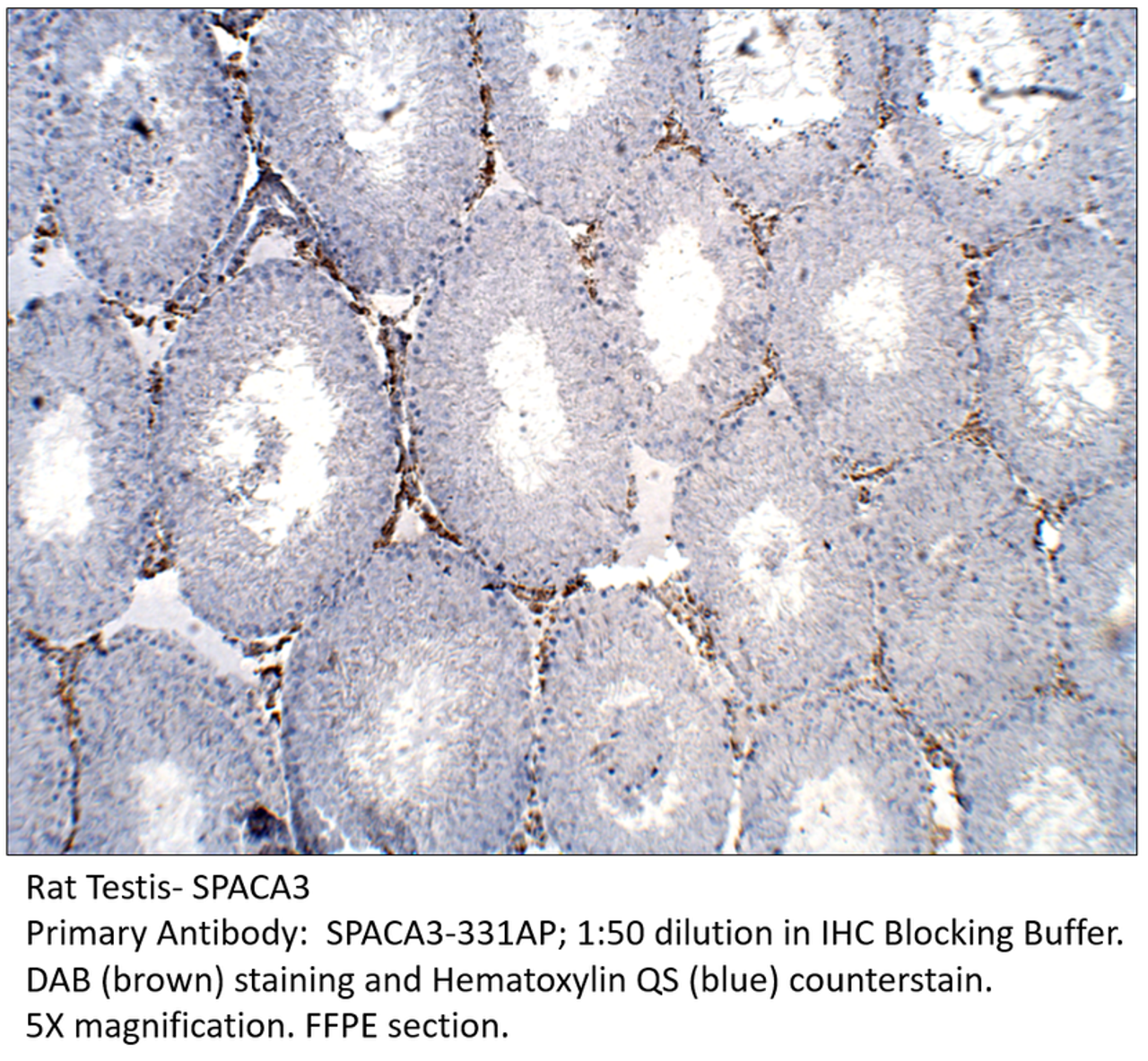 SPACA3 Antibody from Fabgennix