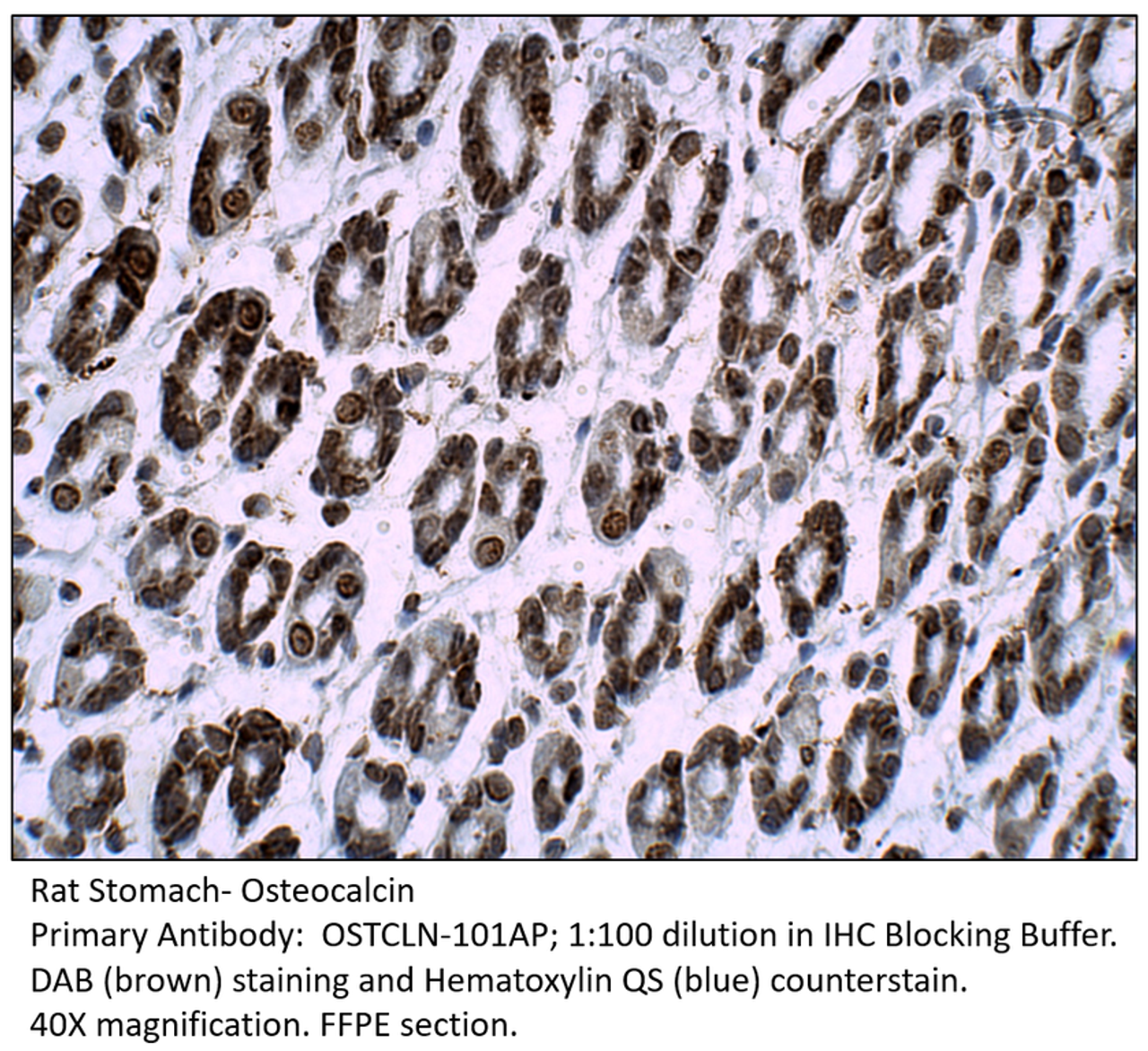 Osteocalcin Antibody from Fabgennix