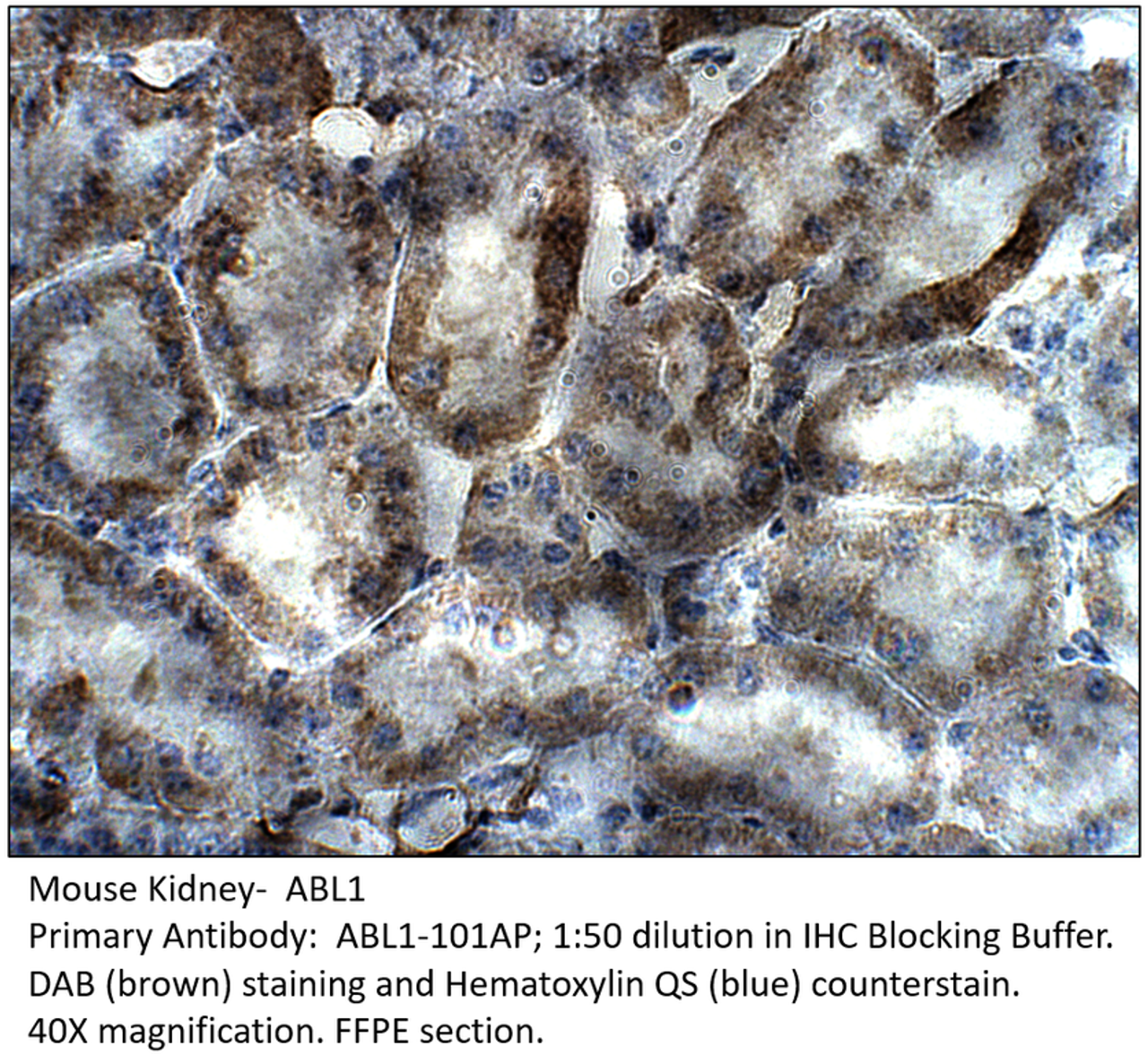 ABL1 Antibody from Fabgennix