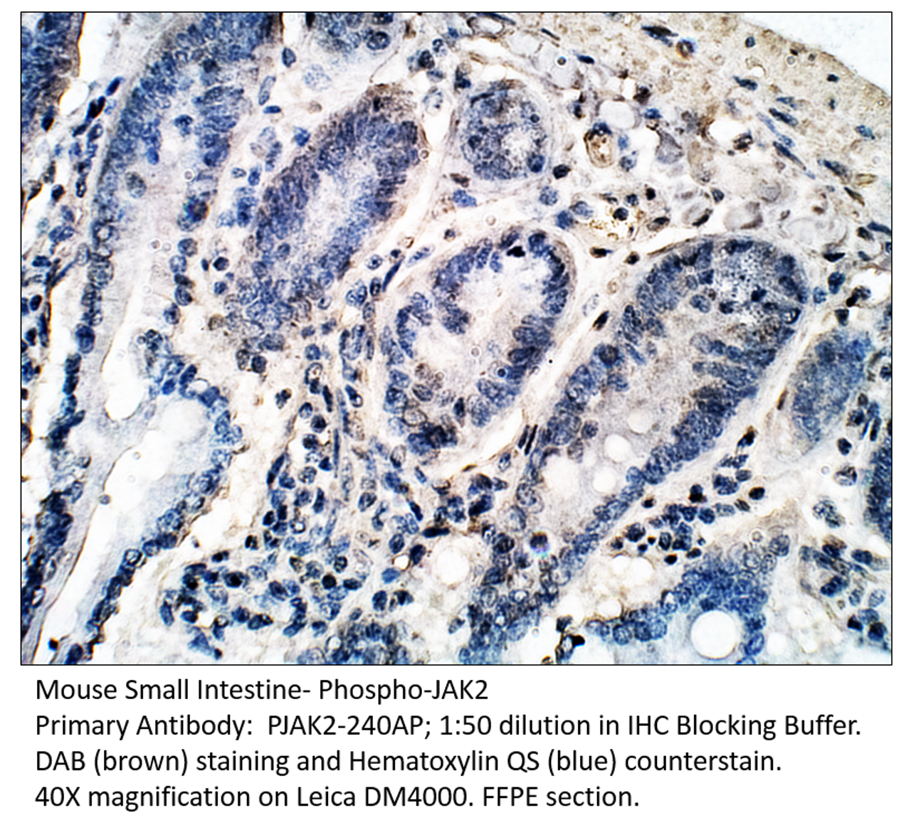 Phospho-JAK2 Antibody from Fabgennix