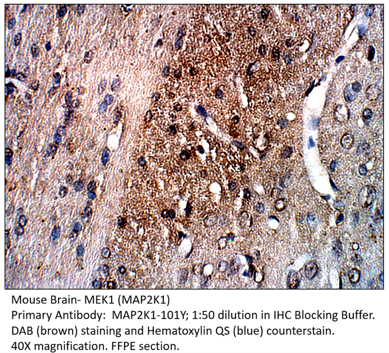MAP2K1 Antibody from Fabgennix