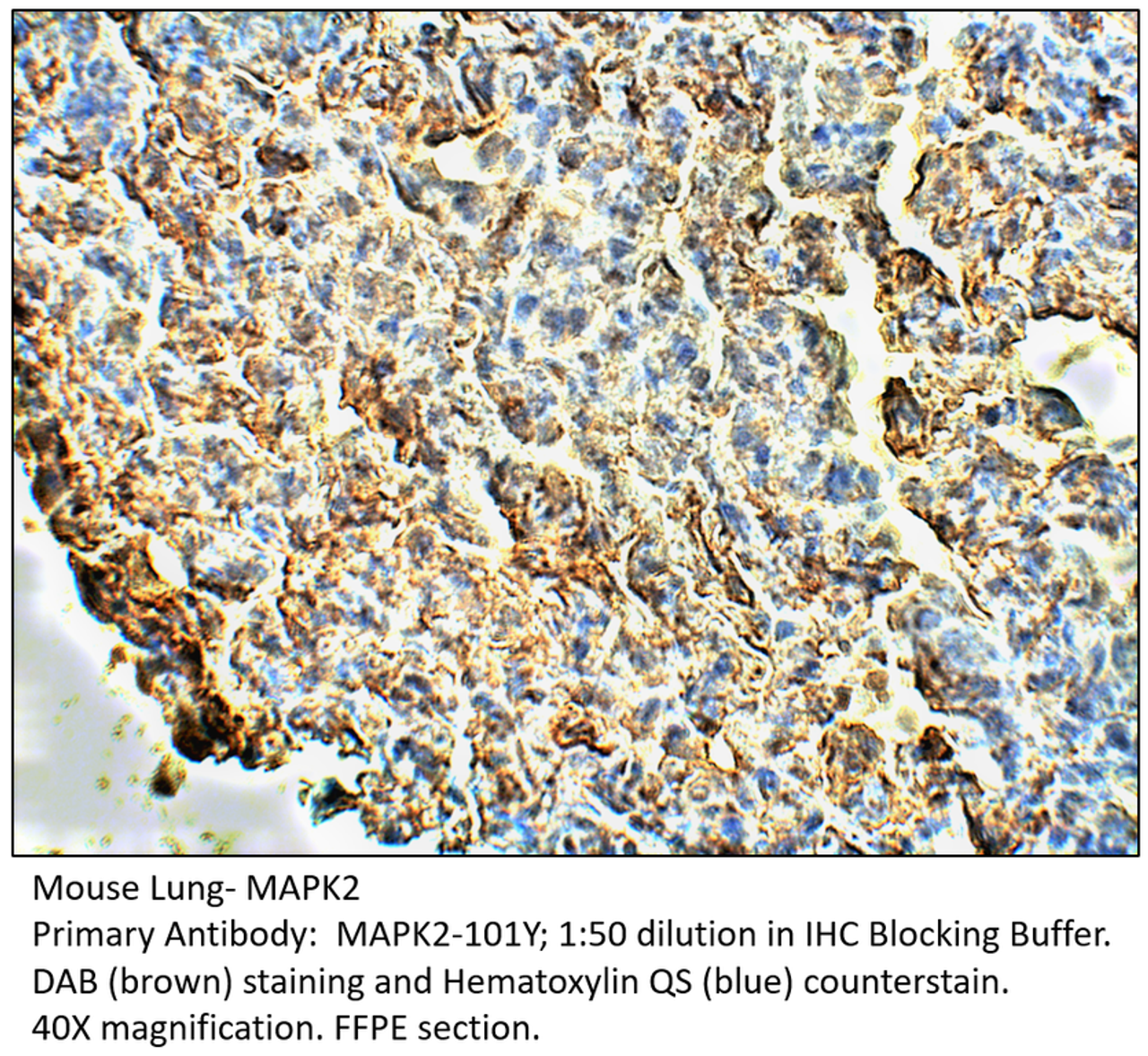 MAPK2 Antibody from Fabgennix