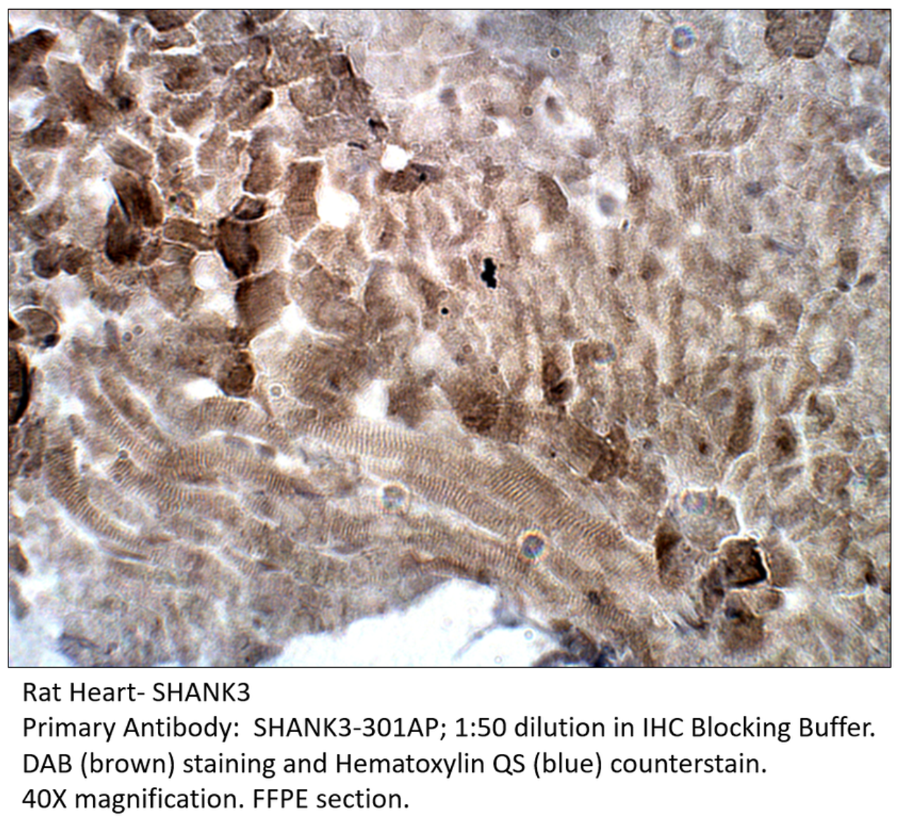 SHANK3 Antibody from Fabgennix