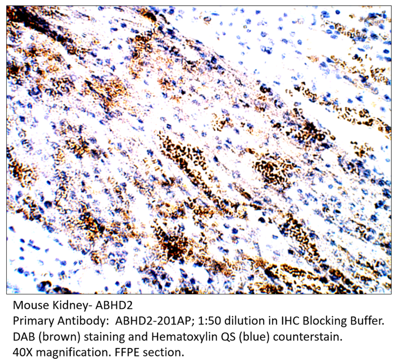 ABHD2 Antibody from Fabgennix