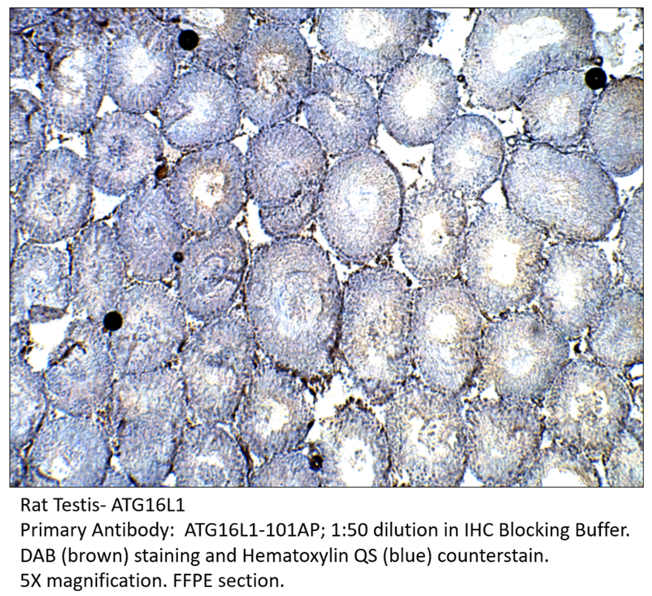 ATG16L1 Antibody from Fabgennix