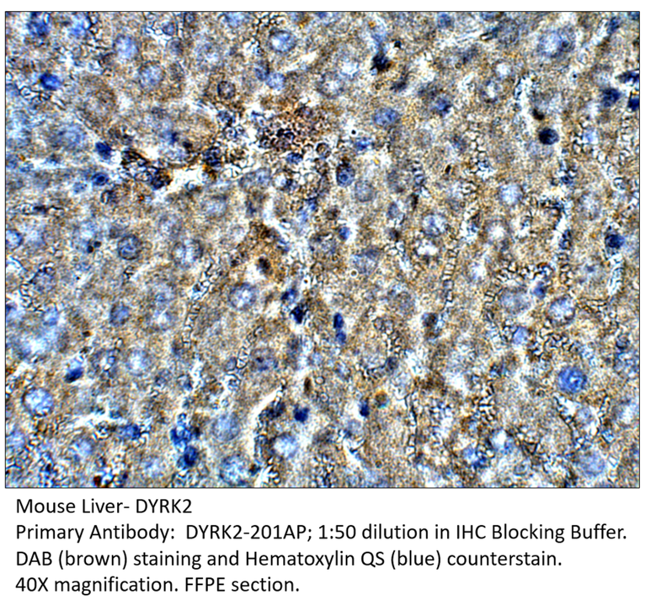 DYRK2 Antibody from Fabgennix