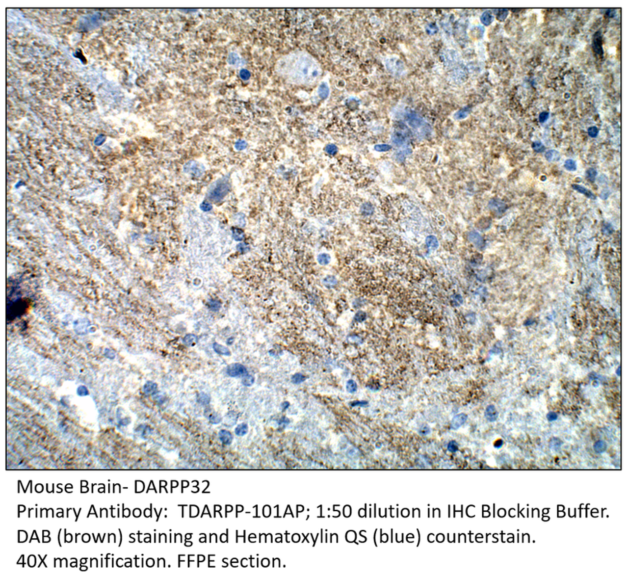 DARPP32 Antibody from Fabgennix