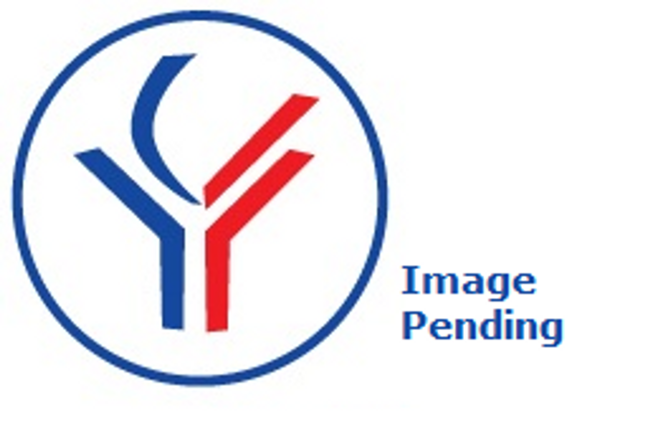 MeCP2 isoform 1 Antibody FITC from Fabgennix