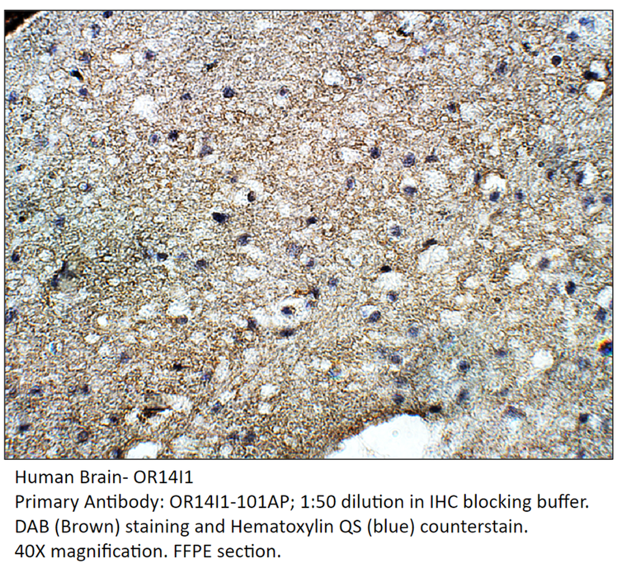 OR14I1 Antibody from Fabgennix