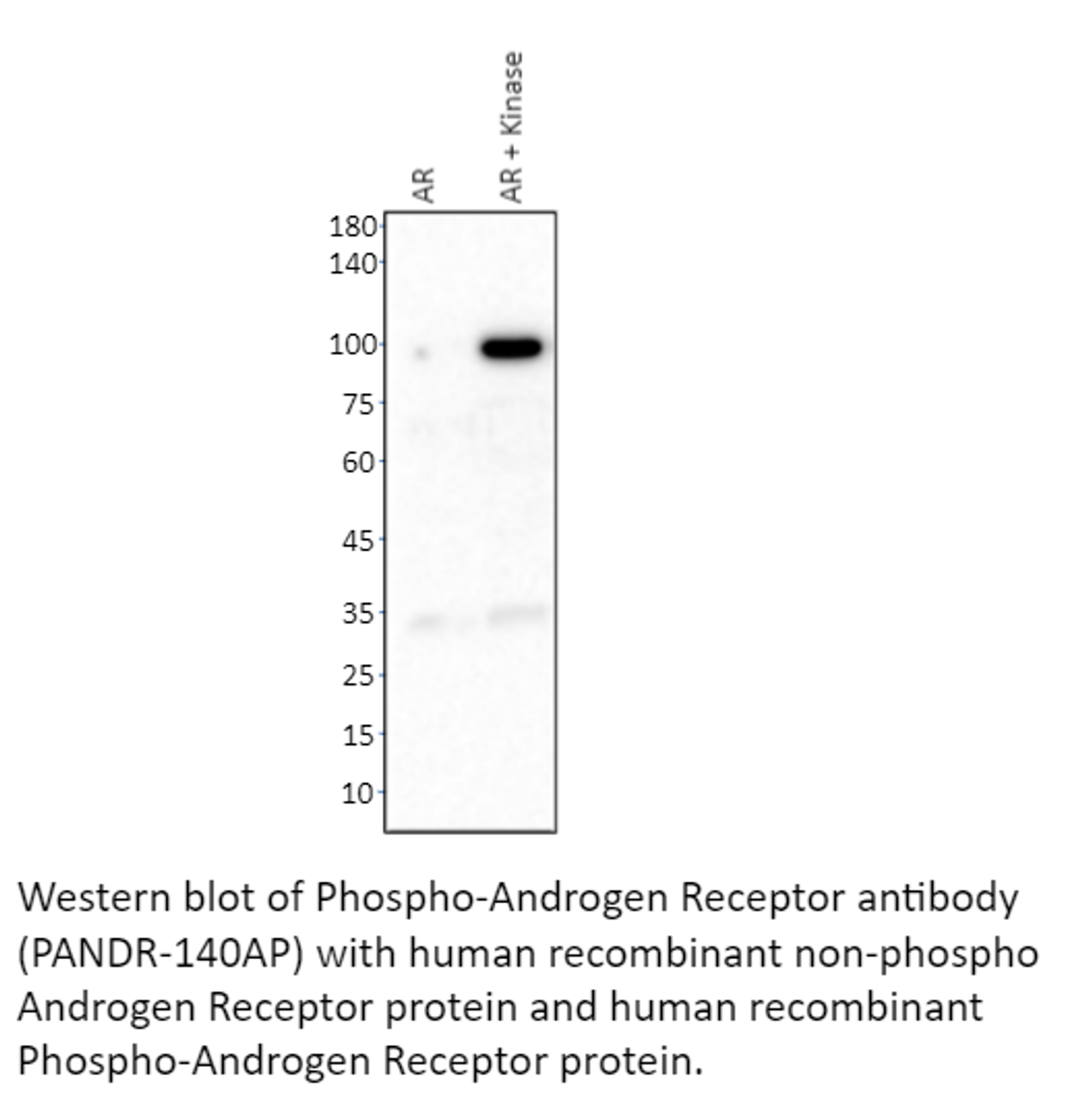 Phospho-Androgen Receptor Antibody from Fabgennix