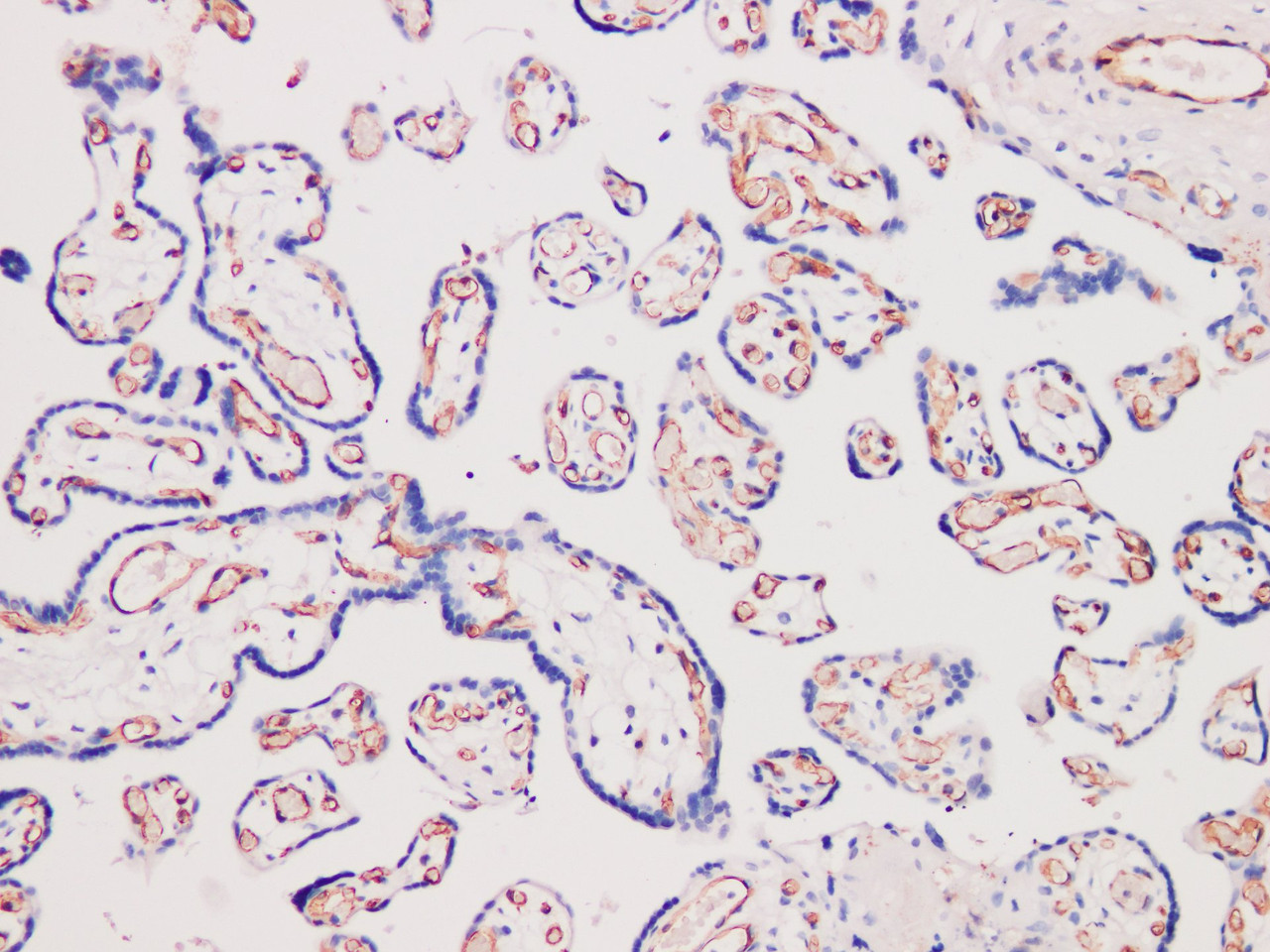 Immunohistochemistry of paraffinembedded Human placental tissue with CD31 Monoclonal Antibody(Antigen repaired by EDTA).