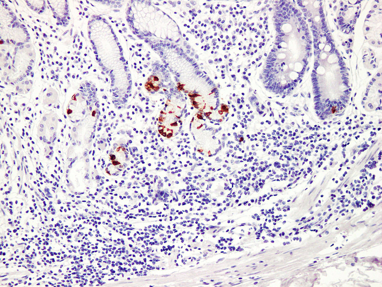 Immunohistochemistry of paraffinembedded Human stomach tissue with Gastrin Monoclonal Antibody(Antigen repaired by EDTA).