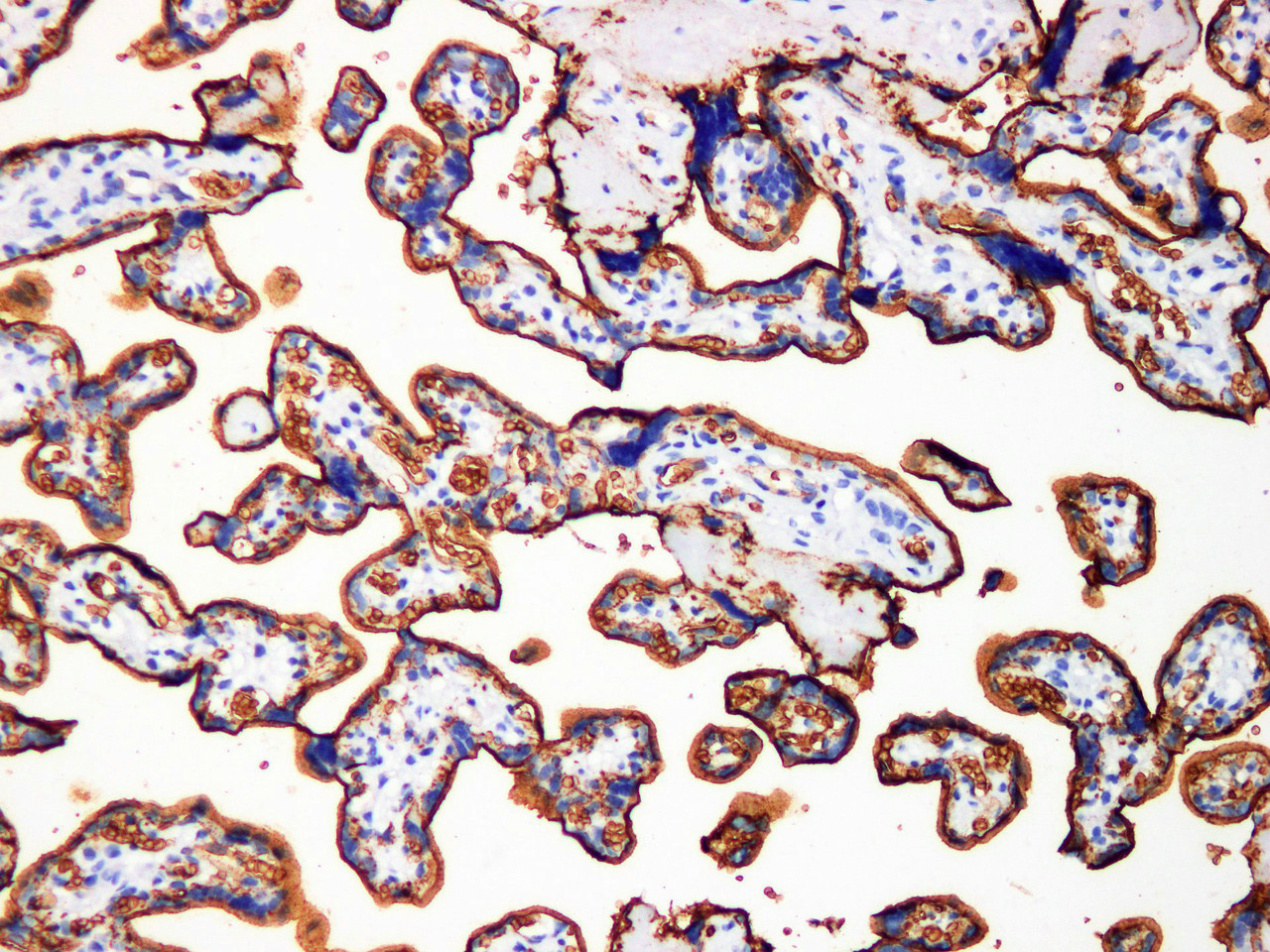 Immunohistochemistry of paraffinembedded Human placental tissue with GLUT-1 Monoclonal Antibody(Antigen repaired by EDTA).