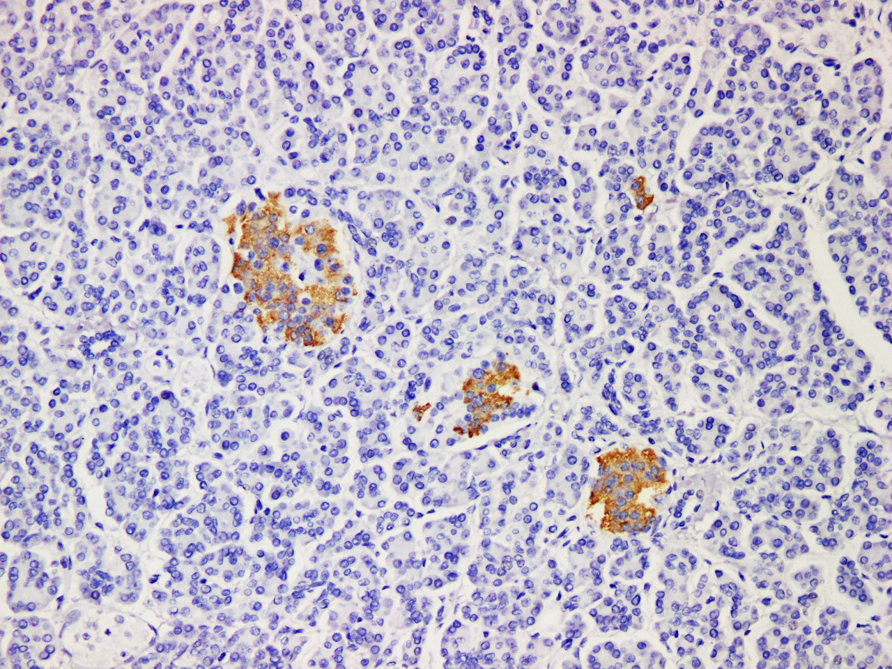 Immunohistochemistry of paraffinembedded Human pancreatic tissue with Insulin Monoclonal Antibody(Antigen repaired by EDTA).