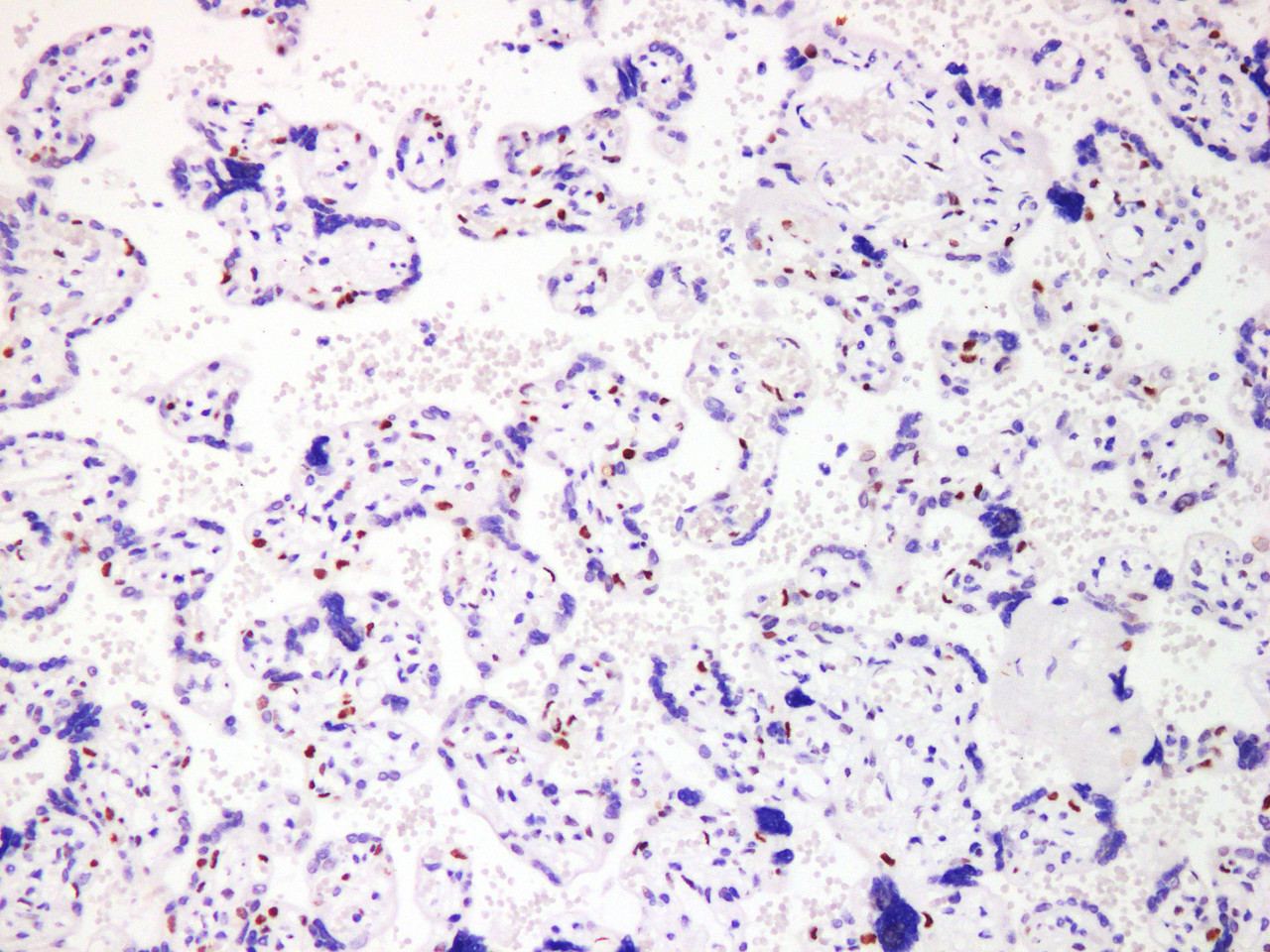 Immunohistochemistry of paraffinembedded Human placental tissue with p57 Monoclonal Antibody(Antigen repaired by EDTA).