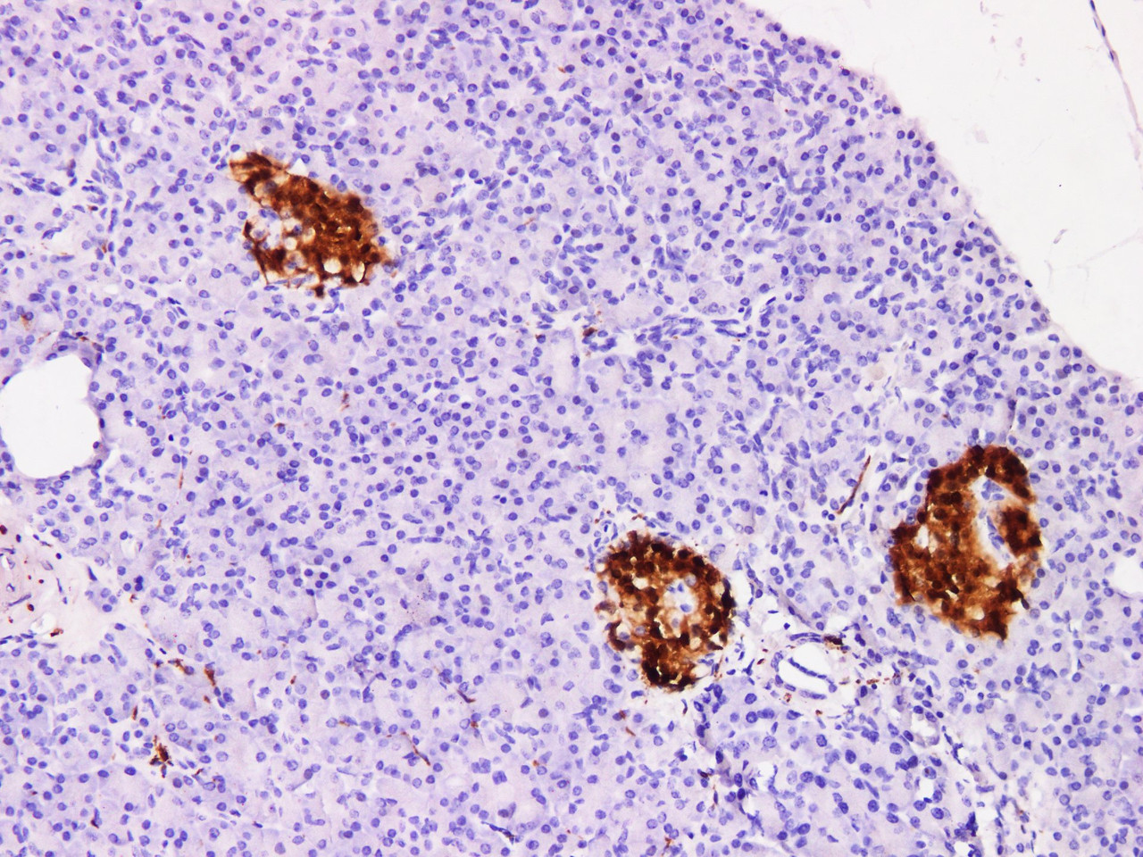 Immunohistochemistry of paraffinembedded Human pancreatic tissue with Protein Gene Product 9.5(PGP 9.5) Monoclonal Antibody(Antigen repaired by EDTA).