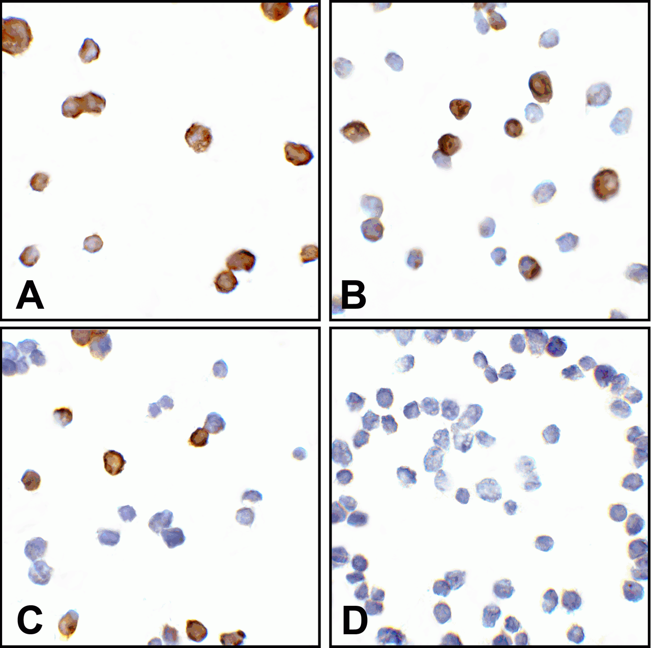 Immunocytochemistry of CTLA-4 in overexpressing 293 cells using (A) RF16011, (B) RF16012, (C) RF16013, and (D) control mouse IgG antibody at 5 &#956;g/ml.