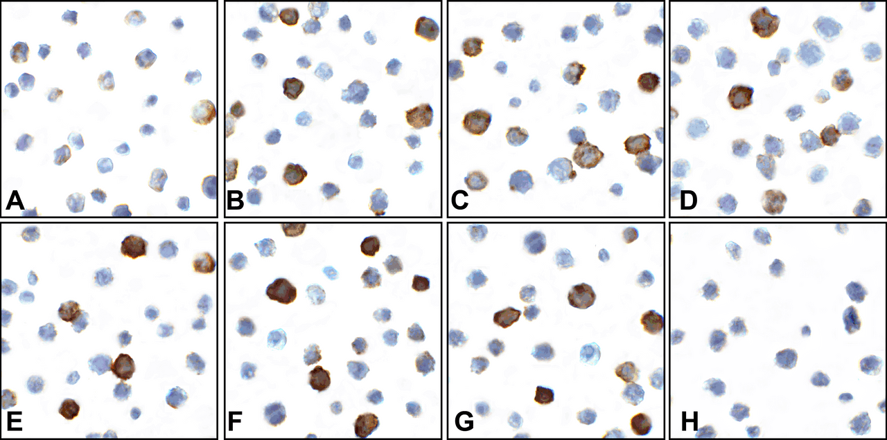 Immunocytochemistry of CD80 in overexpressing HEK293 cells using (A) polyclonal CD80 antibody, (B) RF16041, (C) RF16042, (D) RF16043, (E) RF16044, (F) RF16045, (G) RF16046 and (H) control mouse IgG antibody at 1 &#956;g/ml.