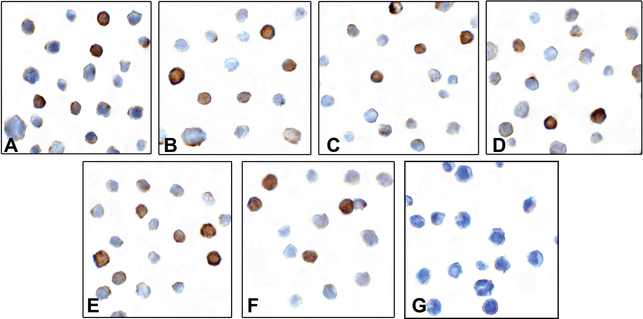 Immunocytochemistry of TIGIT in over expressing HEK293 cells using (A) RF16051, (B) RF16053, (C) RF16054, (D) RF16055, (E) RF16056, (F) RF16058, and (G) control mouse IgG antibody at 1 &#956;g/ml.