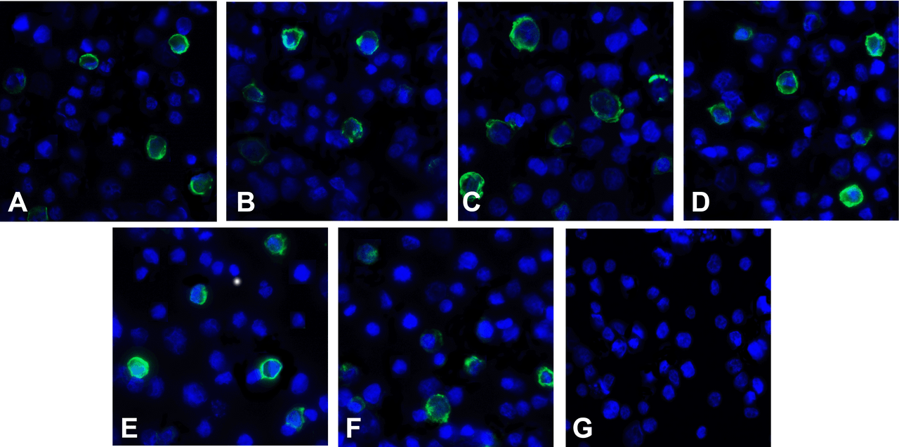 Immunofluorescence of TIGIT in over expressing HEK293 cells using (A) RF16051, (B) RF16053, (C) RF16054, (D) RF16055, (E) RF16056, (F) RF16058, and (G) control mouse IgG antibody at 1 &#956;g/ml.