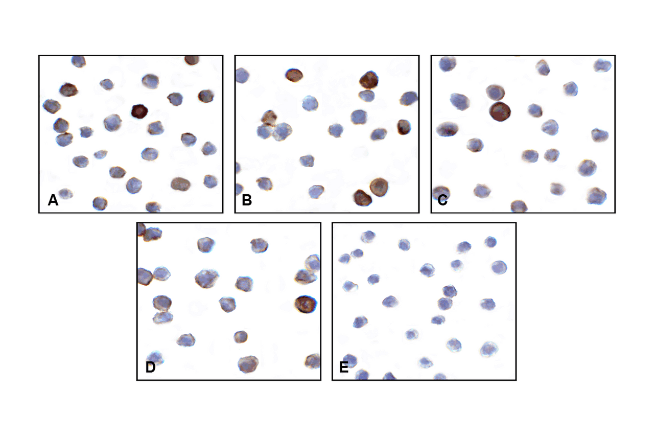 Immunocytochemistry of VISTA in over expressing HEK293 cells using (A) RF16071, (B) RF16072, (C) RF16073, (D) RF16074, and (E) control mouse IgG antibody at 1 &#956;g/ml.