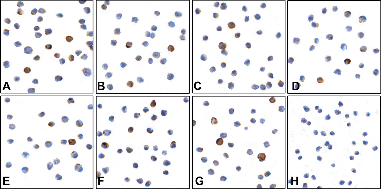 Immunocytochemistry of LAG-3 in over expressing HEK293 cells using (A) RF16082, (B) RF16083, (C) RF16084, (D) RF16086, (E) RF16087, (F) RF16088, (G) RF16089, and (H) control mouse IgG antibody at 1 &#956;g/ml.