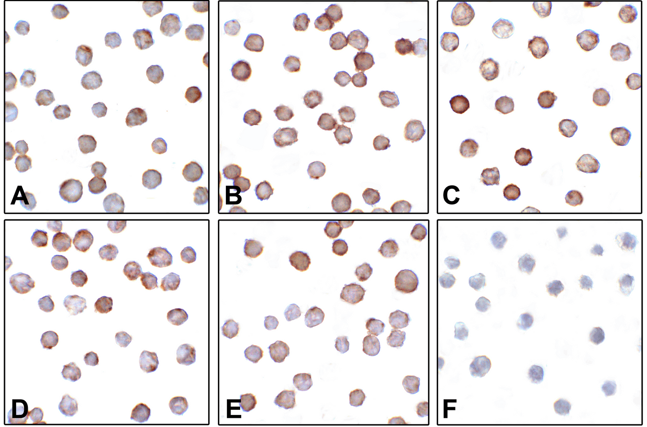 Immunocytochemistry of B7-H3 in HEK293 cells using (A) RF16091, (B) RF16092, (C) RF16093, (D) RF16094, (E) RF16095, and (F) control mouse IgG antibody at 1 &#956;g/ml.