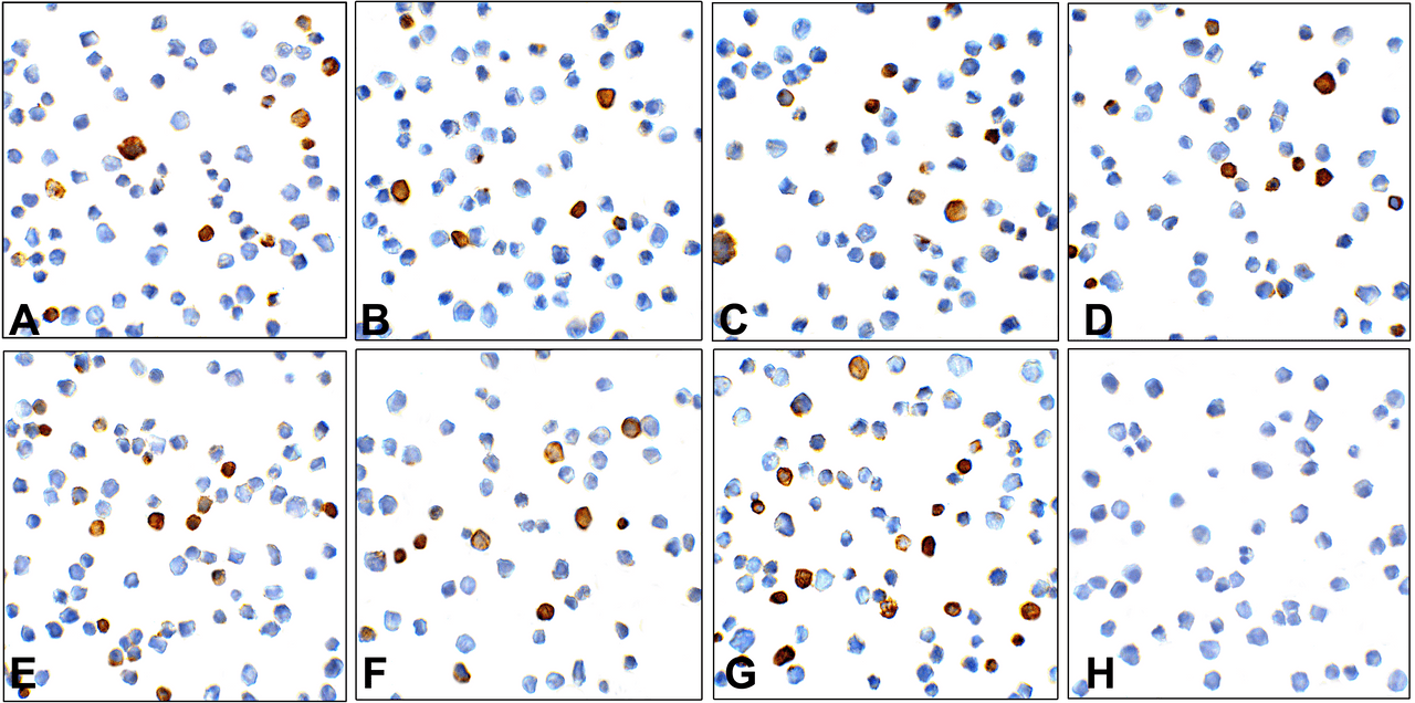 Immunocytochemistry of TIM-3 in over expressing HEK293 cells using (A) RF16103, (B) RF16104, (C) RF16105, (D) RF16106, (E) RF16107, (F) RF16108, (G) RF16109, and (H) control mouse IgG antibody at 1 &#956;g/ml.