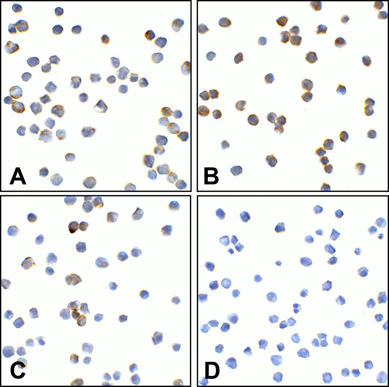 Immunocytochemistry of TMIGD2 in transfected HEK293 cells using (A) RF16121, (B) RF16121, (C) RF16123, and (D) control mouse IgG antibody at 2 &#956;g/ml.