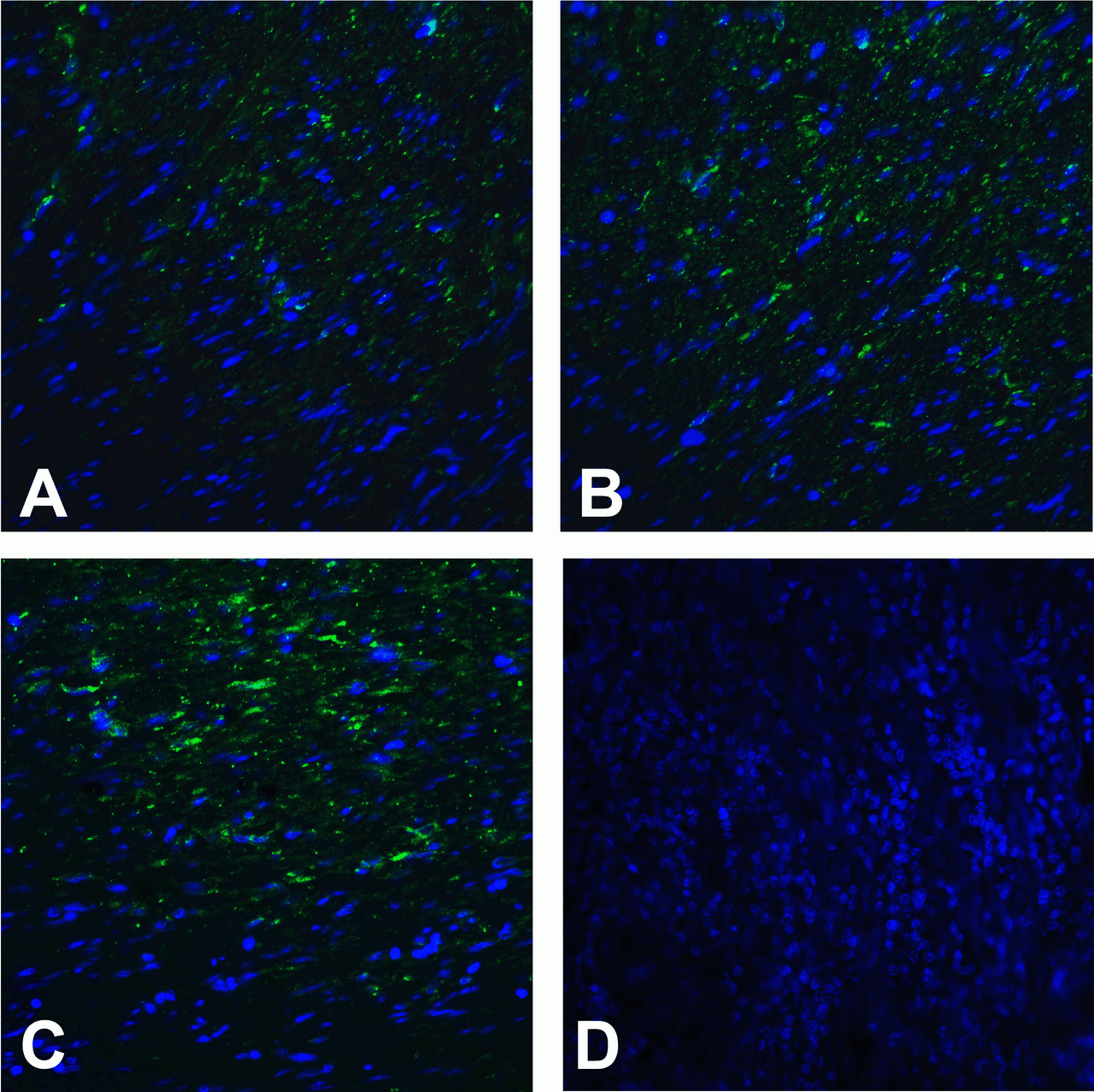 Immunofluorescence of TMIGD2 in human colon carcinoma tissue using (A) RF16121, (B) RF16122, (C) RF16123, and (D) control mouse IgG antibody at 20 &#956;g/ml.