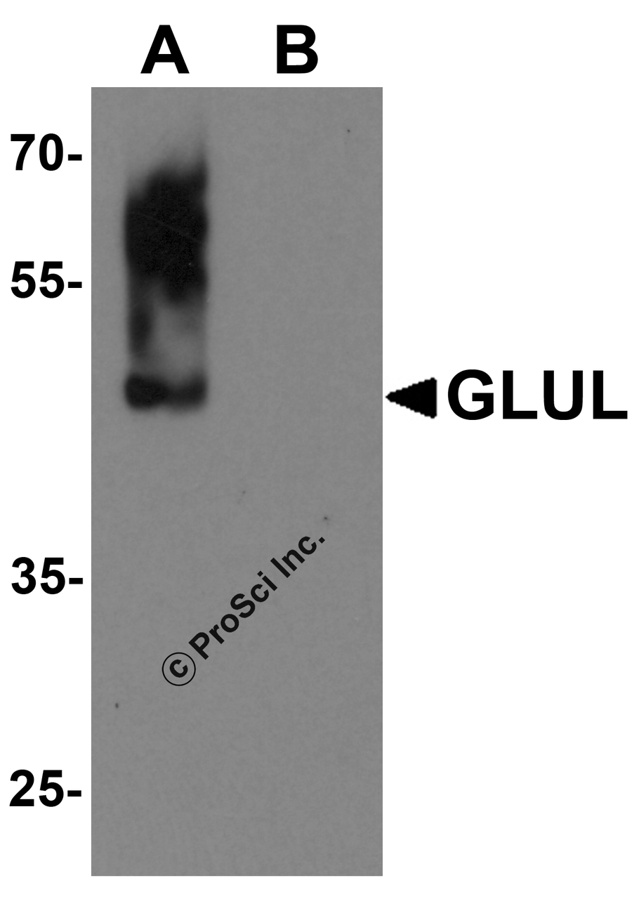 Western blot analysis of GLUL in human brain tissue lysate with GLUL antibody at 0.5 &#956;g/mL in (A) the absence and (B) the presence of blocking buffer.