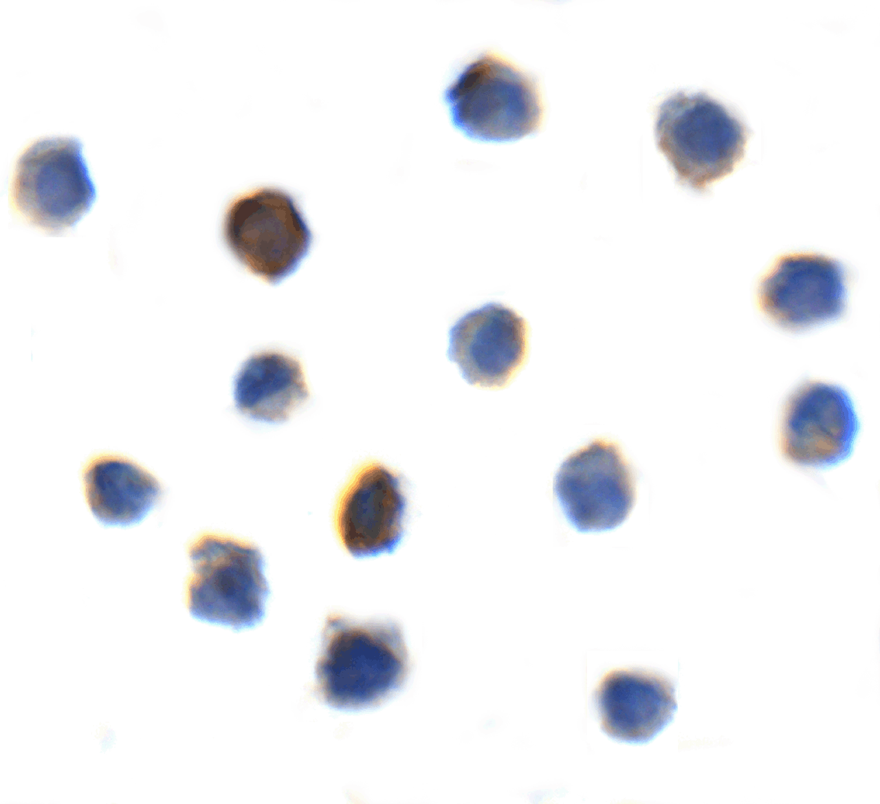 Immunocytochemistry of TIGIT in transfected HEK293 cells with TIGIT single domain antibody at 10 &#956;g/mL.