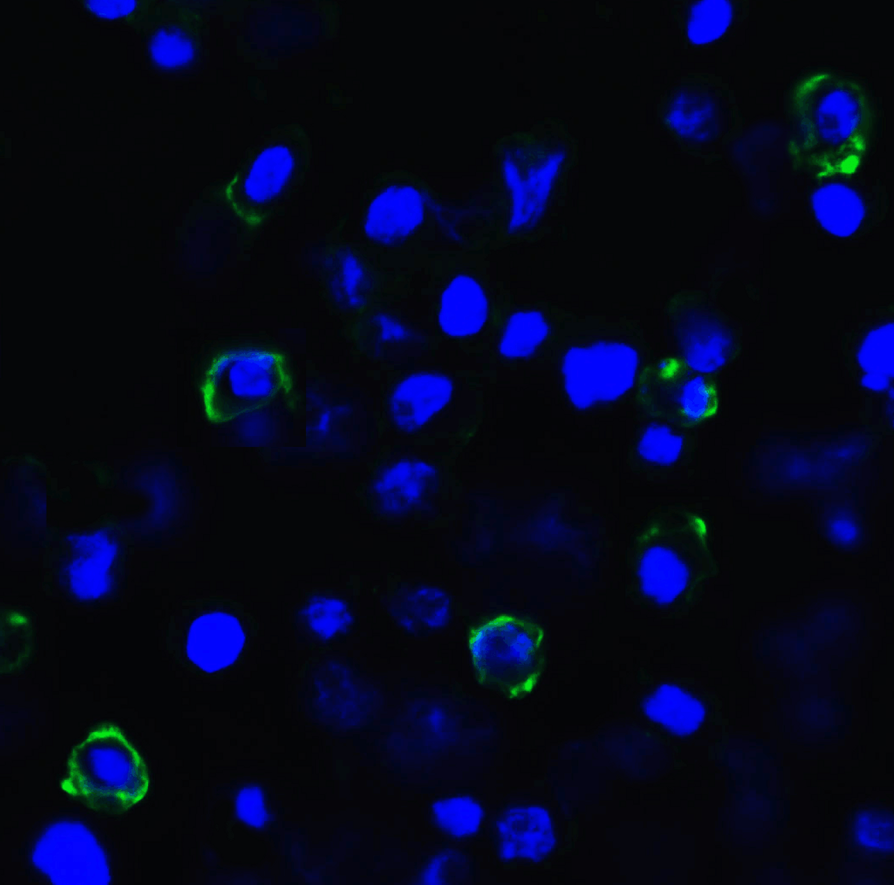 Immunofluorescence of TIGIT in transfected HEK293 cells with TIGIT single domain antibody at 20 &#956;g/mL.