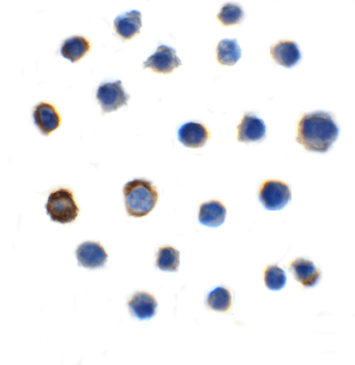 Immunocytochemistry of TIGIT in transfected HEK293 cells with TIGIT single domain antibody at 10 &#956;g/mL.