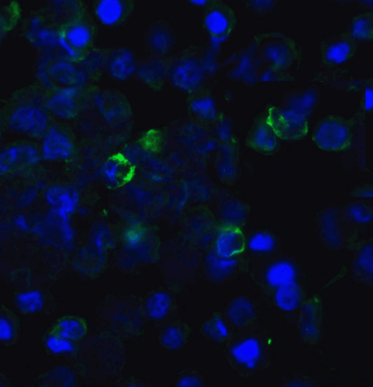 Immunofluorescence of TIGIT in transfected HEK293 cells with TIGIT single domain antibody at 20 &#956;g/mL.