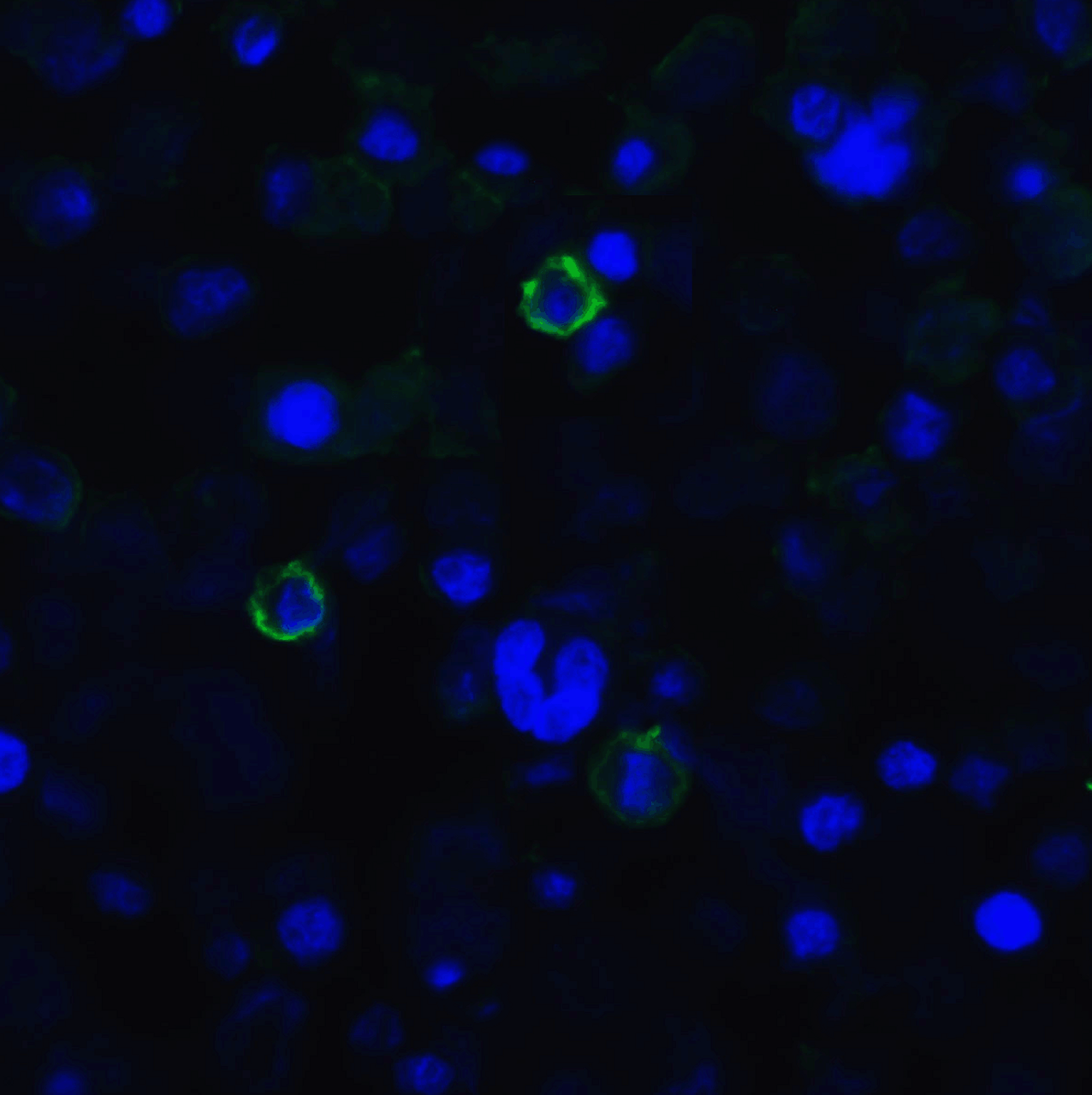 Immunofluorescence of TIGIT in transfected HEK293 cells with TIGIT single domain antibody at 20 &#956;g/mL.